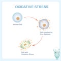 Oxidative stress scheme. Healthy cell caused by an attack of free radicals Royalty Free Stock Photo